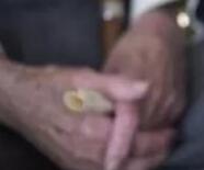 风湿性关节炎的早期症状有什么.jpg